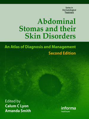 cover image of Abdominal Stomas and Their Skin Disorders